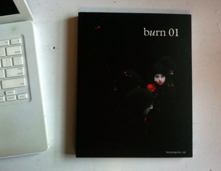 Burn01